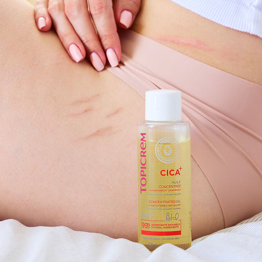 Topicrem Cica Stretch Marks & Scars Concentrated Oil 100ml
