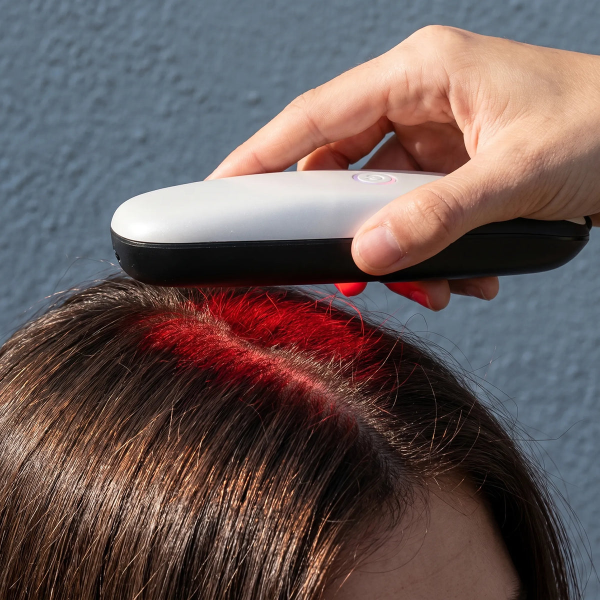 TCR Laser Hair Treatment